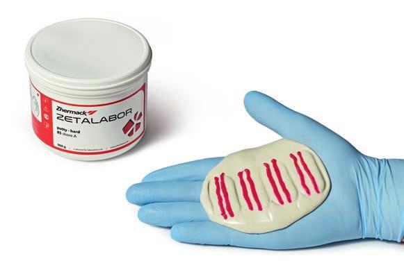 della protesi. Materiali utilizzati: Zetalabor, Villacryl S.