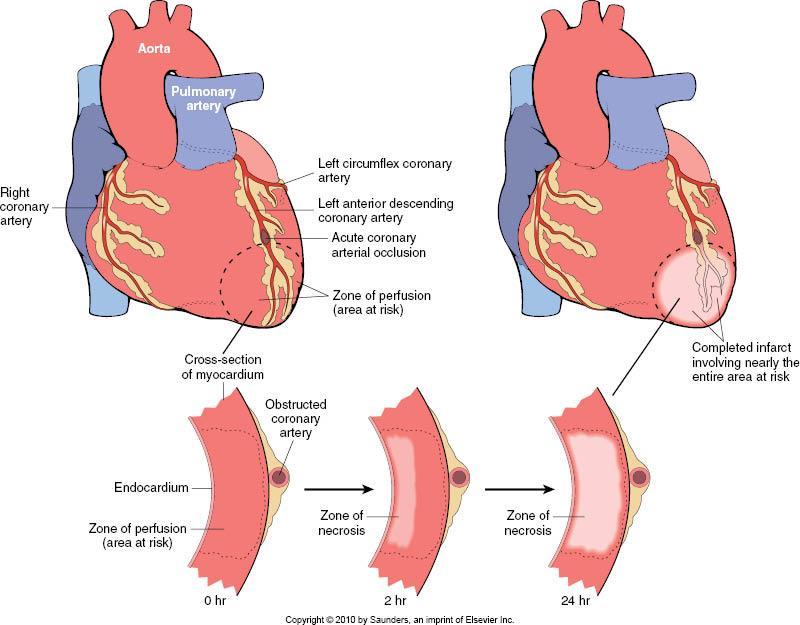 irreversibile Lesioni