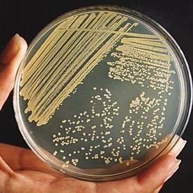 Ciascuna colonia è formata da milioni di cellule batteriche,