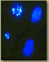 La cellula in apoptosi subisce