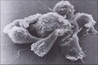 Le cellule della immunità innata Cellule natural killer (NK) Classe di linfociti.