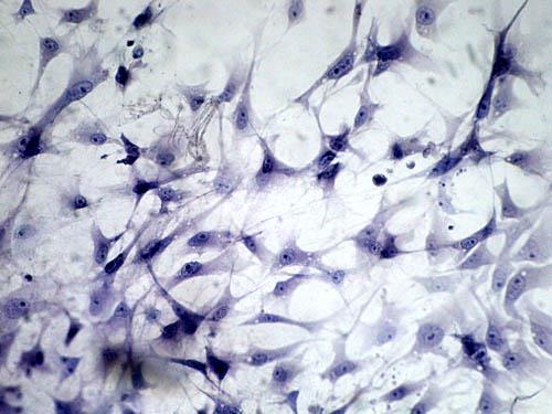 Fibroblasti Cellule tessutali con funzioni di: Produzione dei componenti della matrice extracellulare