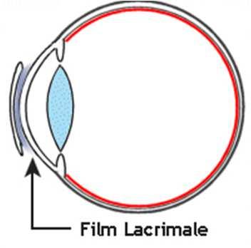 sferica Rigida Gas Permeabile ad un occhio astigmatico lo strato di liquido lacrimale che si