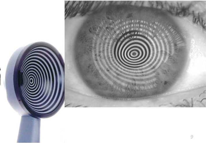 ) 9 Peculiarità dell astigmatismo regolare Gli assi dei meridiani principali sono tra loro perpendicolari.