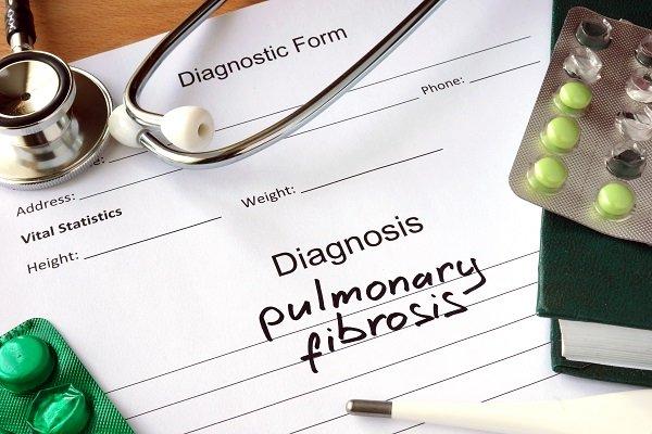 È una malattia rara, ma non per questo poco diffusa, anzi: la fibrosi polmonare idiopatica è la più frequente delle malattie