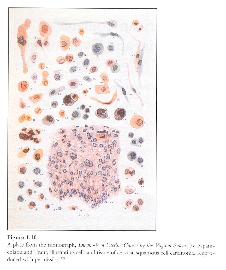 La riproducibilità del Pap test e la possibilità di confronto di diagnosi citologiche fra programmi dipende dall uniformità della terminologia utilizzata per la refertazione e dai criteri morfologici