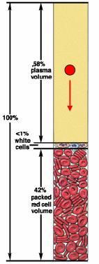Esempio: Calcolo della VES (elocià di cadua globuli rossi in iro) la pare globulare del sangue ha peso specifico superiore a quello del plasma, per cui