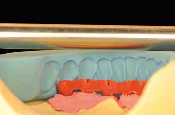 incisoocclusale dei denti anteriori e denti posteriori Fig.