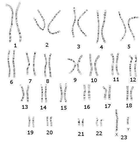 4 Fig. 2: 23 paia di cromosomi sistemati in ordine secondo la dimensione; il cromosoma 1 è il più grande. I due ultimi cromosomi, la 23 coppia (X e Y), sono i cromosomi sessuali.