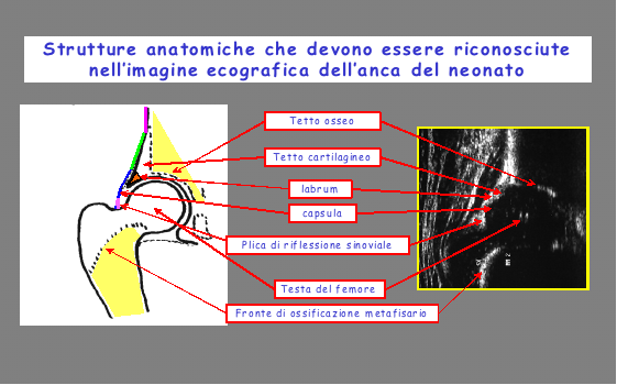 La tecnica di studio ecografico della anche più utilizzata in Italia è quella di Graf ed è questa che verrà descritta in dettaglio.