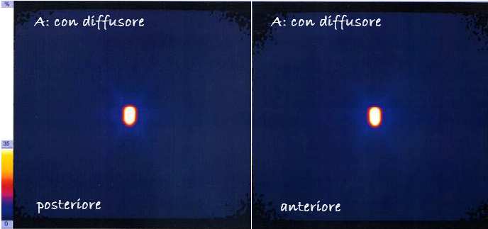 Visualizzazione della sezione assiale di una SPECT eseguita con DaTSCAN, dopo l applicazione della correzione per attenuazione e diffusione (A) e senza correzione (B).