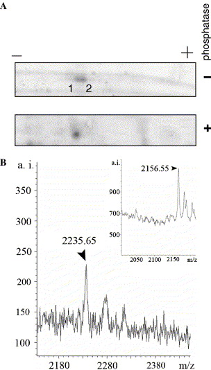 Lysine specific histone demethylase 1 (LSD1): tissue specificity and phosphorylation pattern of the LSD1-8a isoform!