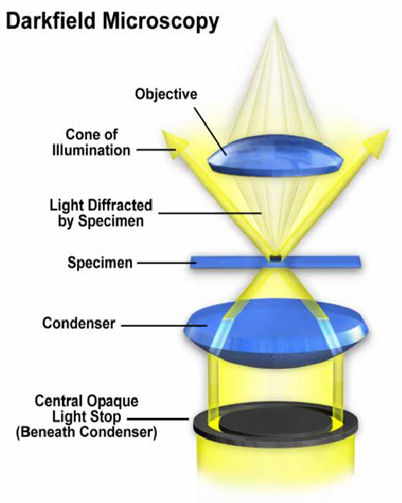 MECCANISMI DI CONTRASTO: MICROSCOPIA OTTICA - Imaging Tecnique - Brightfield (contrasto di ampiezza) - Darkfield (contrasto di diffrazione) - Contrasto di Fase (il raggio attraverso il campione può