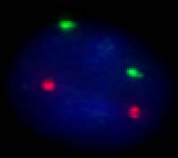 Fig.16: Sonde centromeriche per i cromosomi 8 (rosso) e 12 (verde).