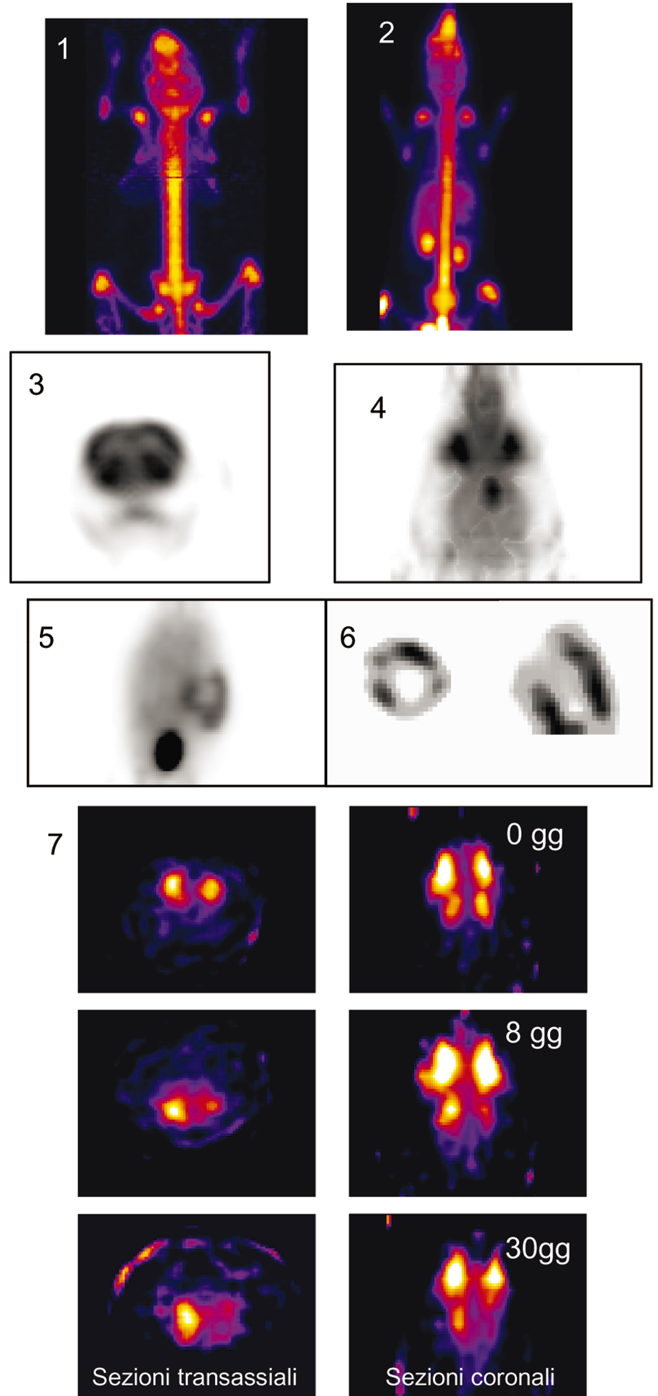 scintillazione rivelata ai lati opposti dello stesso cristallo usando due fotorivelatori, oppure segmentando il cristallo stesso in due strati in modo che il sistema di fotorivelazione sia capace di