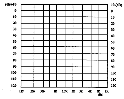 COLLAUDO PROTESI ACUSTICA Numero di Matricola: Audiometria tonale