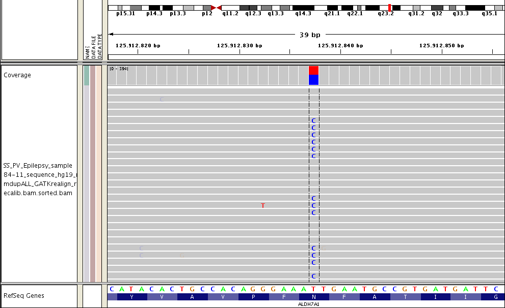 Capitolo 3 Risultati Figura 5: IGV mostra la mutazione p.asn167ser trovata nell'esone 6 del gene ALDH7A1. Il gene ALDH7A1 (OMIM*107.