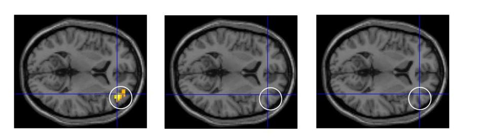 Punishment Probabilistic Reversal Learning Task Loss Less activation Ventro