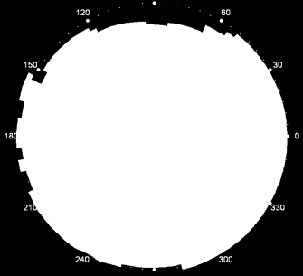 IOL calculation state-of-the-art Formule di calcolo della IOL SRK I: SRK I e II (empiriche) SRK/T, Haigis, Hoffer Q, Holladay 1