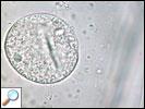 cloroplasti Cellula di cipolla a 400 e 1000 ingr.