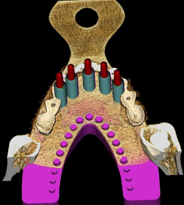 Questa metodologia è pensata per assicurare al professionista un elevato margine di sicurezza, riducendo al minimo la possibilità di imprevisti ed errori.