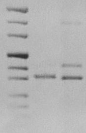 M 1 2 500 bp 400 bp 300 bp 339 bp Fig.17- Gel d agarosio all 1%. Valutazione qualitativa del cdna.