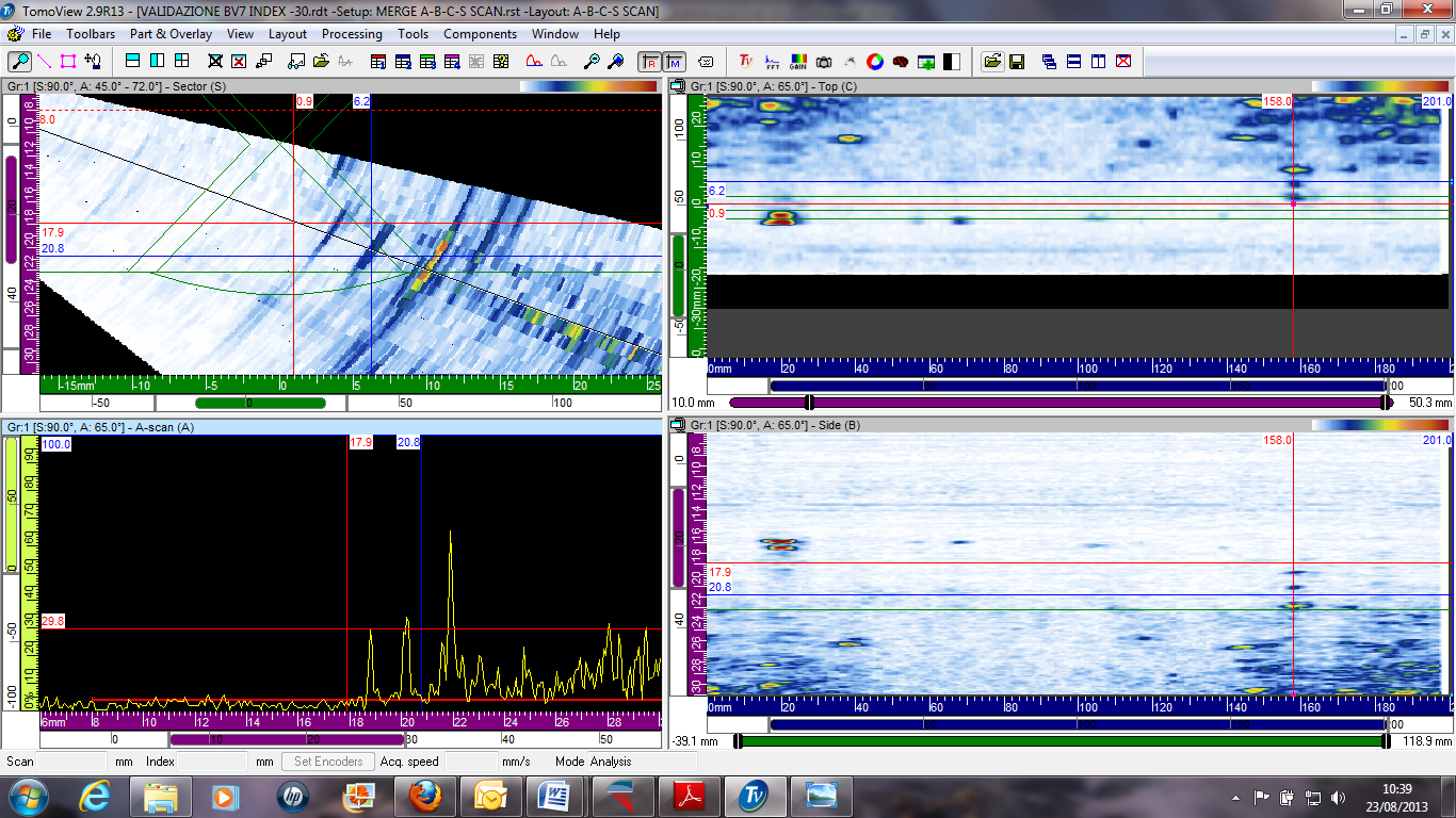 Fig. 11- Rappresentazione Tomoview A-B-C-S scan Fig.