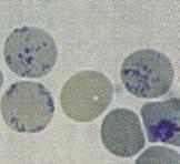 RETICOLOCITI Microscopio ottico: incubazione con coloranti