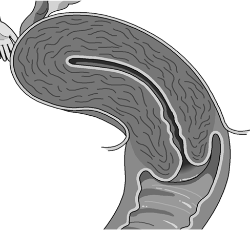 Collegamento tra cervello e sistema ormonale Fattori di rilascio / inibizione