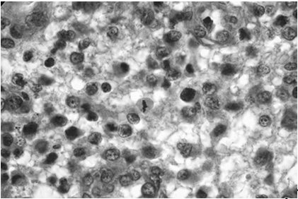 FASE PROLIFERATIVA PRECOCE Epitelio Ristrutturazione dell epitelio luminale (dal 5 giorno) Spessore < 2 mm Rare mitosi cellule della zona basale e delle cellule epiteliali persistenti nei segmenti