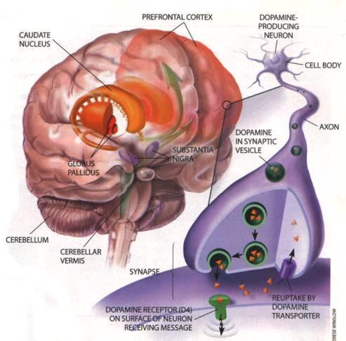 Deficit of Human dopamine