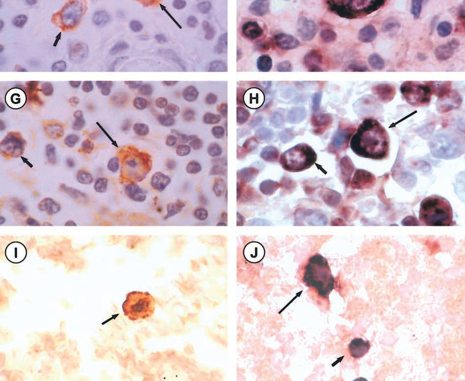 infezioni L utilizzo di kit basati sulla rilevazione dell antigene NS in combinazione con IgM MAC-ELISA potrebbe essere ottimale PLoS Negl Trop Dis.