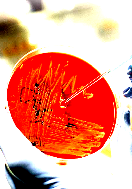 1 MICROBIOLOGY BATTERIOLOGIA INDUSTRIALE CATALOGO GENERALE 2009 Valido dal 02 Marzo 2009 Rev. 1.0 LICKSON S.r.l. Uffici Amm.vi e stabilimento: S.S. 189 (PA-AG) - C.