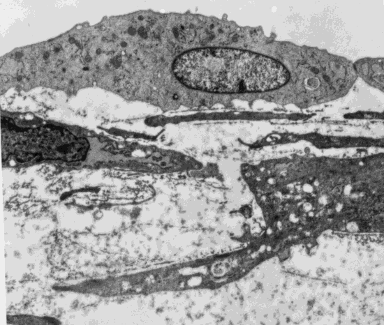 RSULTT: SPRSS DL FTTR PR-GGC VGF VGF in situ P=0.