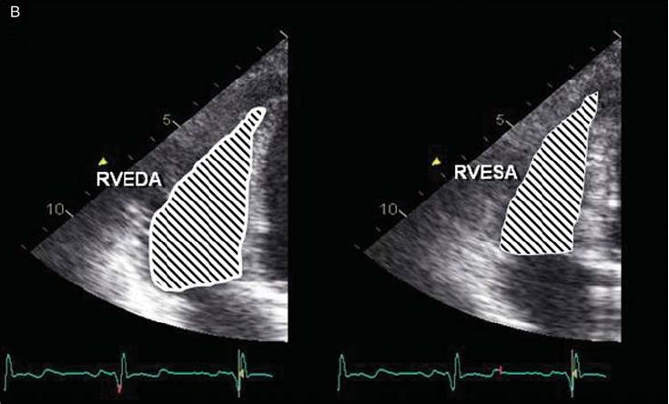 Fractional area change