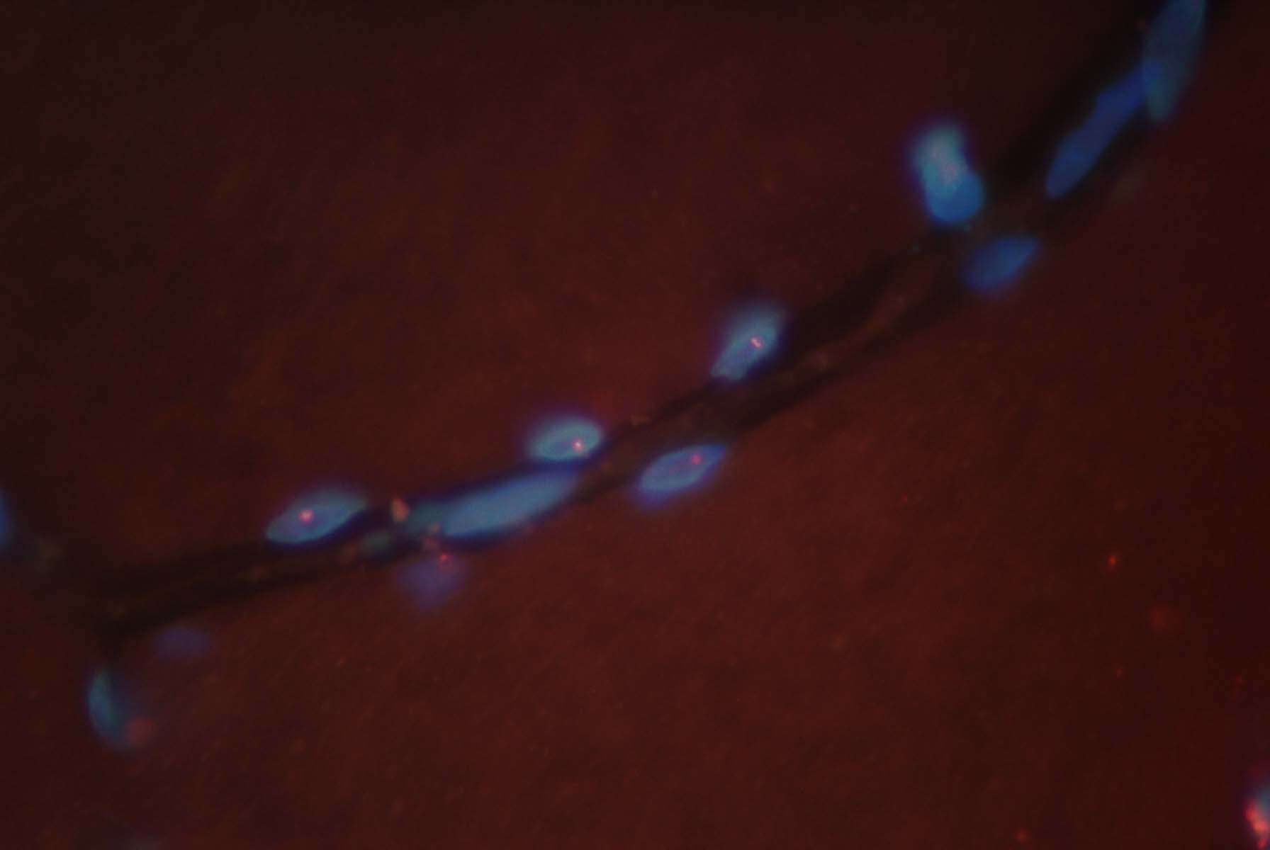 Fig.3 FISH: ingrandimento che mostra la presenza di puntini luminosi rossi (inclusioni di RNA) all'interno dei nuclei (aree blu).