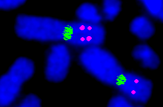 un extra cromosoma Per definire lo stato di metilazione di un marcatore (ad es.