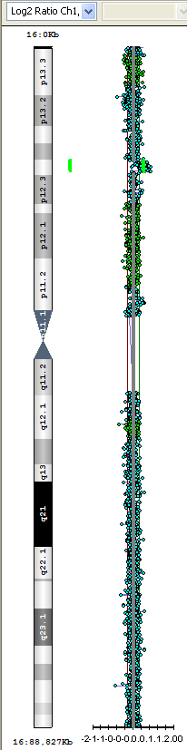 ALTERAZIONE PATOLOGICA MA NON ASSOCIATO AL FENOTIPO RIS ORIGINE Mb START END dup 16p13.12-p13.11 pat 1,5 14,687,665 16,218,541 dup 15q13.2-q13.