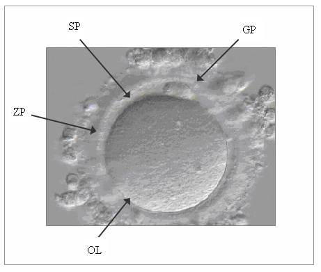 Fig. 3 Ovocita denudato dove vengono mostrate le componenti principali visibili al microscopio ottico. GP = globulo polare; SP = spazio perivitellino; ZP = zona pellucida; OL = oolemma.