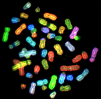 I tumori spesso originano da traslocazioni cromosomiche Linfoma di Burkitt traslocazione