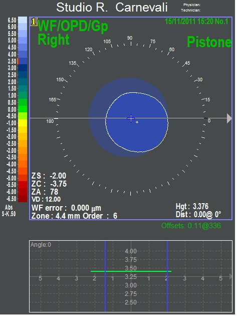 la seconda determina invece il deterioramento del contrasto in funzione della frequenza spaziale.