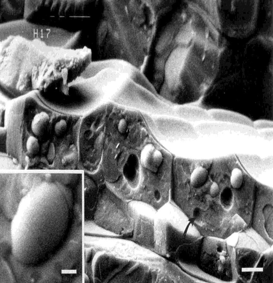 Ciò vuol dire che riempie tutta la cellula e che i vacuoli sono ancora inesistenti o molto piccoli. Inoltre non ci sono inclusioni vacuolari.