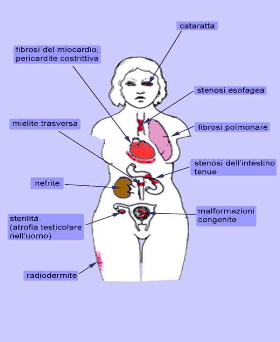 Stenosi e fibrosi sono conseguenza di un processo