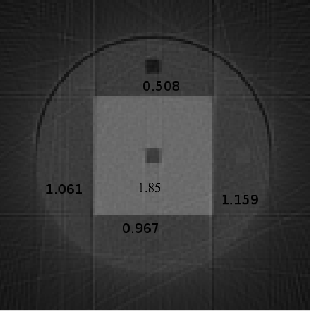 4.4 Struttura dei fantocci ricostruiti 84 Figura 4.5: Immagine pct (sono indicate le densità relative) osso compatto 1.850g/cm 3. Come si nota chiaramente in (fig.4.5), purtroppo la piccola