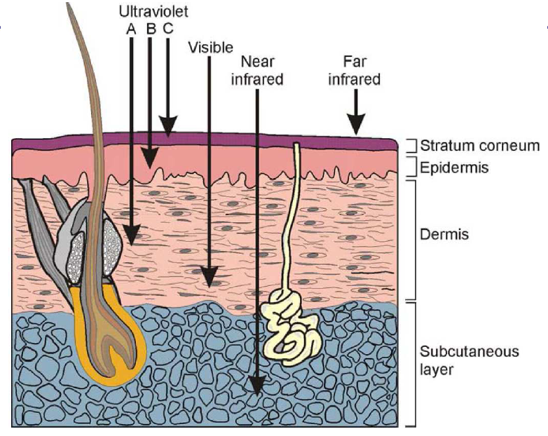 IR CATARATTA azione termica (IR-A iride; IR-B e IR-C cornea) nucleare (degenerazione