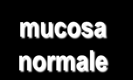 malattia celiaca latente mucosa normale malattia