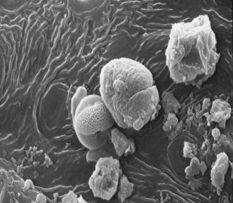 POTENZIALITA DI ASSORBIMENTO DEGLI INQUINANTI ATMOSFERICI STUDI ISTOLOGICI STIMA STUDI MICRO-MORFOLOGICI