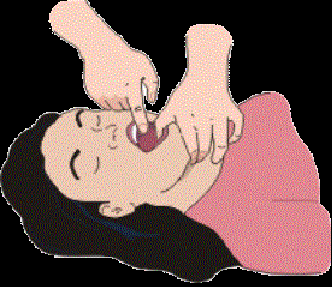 Controllo delle Le manovre di base da eseguire sono: Apertura della bocca e