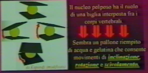 Struttura disco interventerbrale In caso di degenerazione dell anello fibroso il nucleo polposo puo prolassare o