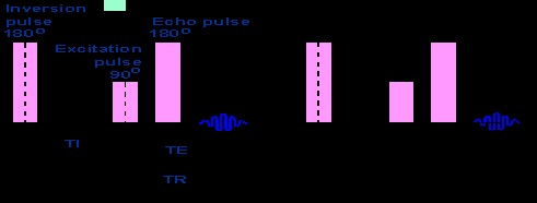 Fig. 3: Sequenza Spin Echo. La magnetizzazione dopo essere stata messa sul piano trasversale dall'impulso a 90, decade, dovuta alla perdita di coerenza degli spins.